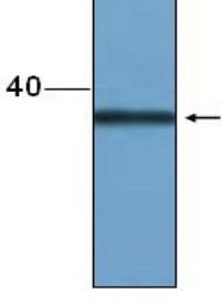 BZR1 | Brassinazole resistant 1 (Oryza sativa) in the group Antibodies Plant/Algal / Hormones / Brassinosteroids/regulation at Agrisera AB (Antibodies for research) (AS16 3219)